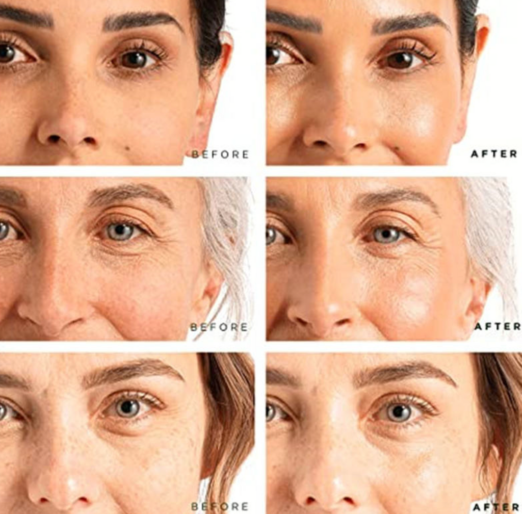 Advanced Skin Brightening Cream